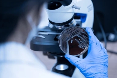 Development and Validation of Microbiology Methods