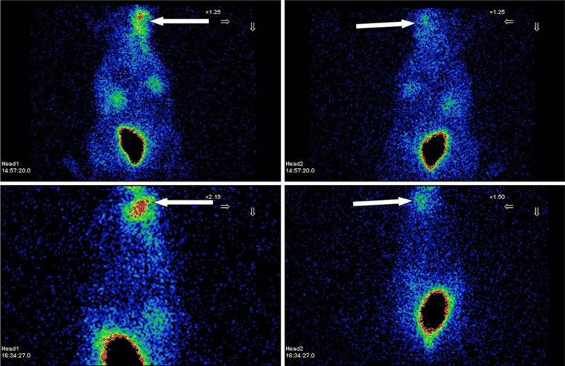 Synthesis of EDDA-Based (99m)Tc-5-Fluorouracil for Brain Imaging